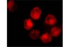 Immunofluorescence staining of K562 cells using AP30017PU-N ADAM10 antibody at 10 μg/ml. (ADAM10 抗体  (C-Term))