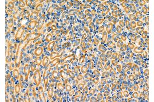 ABIN6263586 and ABIN6276332 at 1/100 staining Mouse kidney tissue by IHC-P. (NEFL 抗体  (N-Term))