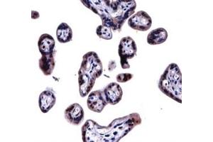 SOCS6 antibody immunohistochemistry analysis in formalin fixed and paraffin embedded human placenta tissue. (SOCS6 抗体  (AA 40-69))