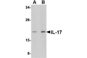Western blot analysis of IL-17 in A-20 lysate with AP30409PU-N IL-17 antibody at (A) 2 and (B) 4 μg/ml. (Interleukin 17a 抗体  (N-Term))
