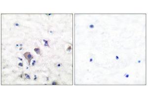 Immunohistochemistry (IHC) image for anti-Glutamate Receptor, Ionotropic, AMPA 2/3 (GRIA2/3) (C-Term) antibody (ABIN1848570) (mGluR2/3 抗体  (C-Term))