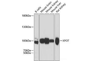 Western blot analysis of extracts of various cell lines using XPOT Polyclonal Antibody at dilution of 1:3000. (XPOT 抗体)