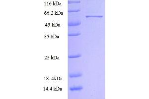 SDS-PAGE (SDS) image for rho Guanine Nucleotide Exchange Factor (GEF) 7 (ARHGEF7) (AA 1-250), (partial) protein (GST tag) (ABIN5712151)