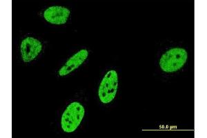 Immunofluorescence of monoclonal antibody to NOTCH3 on HeLa cell. (NOTCH3 抗体  (AA 47-156))