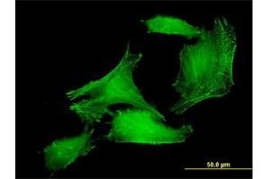 Immunofluorescence of purified MaxPab antibody to PDLIM7 on HeLa cell. (PDLIM7 抗体  (AA 1-457))