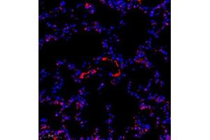 Immunofluorescence (Paraffin-embedded Sections) (IF (p)) image for anti-TBC1 (Tre-2/USP6, BUB2, Cdc16) Domain Family, Member 1 (TBC1D1) antibody (ABIN7075843)