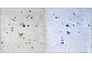 Immunohistochemistry analysis of paraffin-embedded human brain, using PSEN1 (Phospho-Ser357) Antibody. (Presenilin 1 抗体  (pSer357))