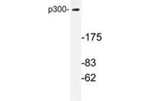 Western blot analysis with EP300 / P300 antibody in extracts from MDA-MB-435 cells. (p300 抗体)