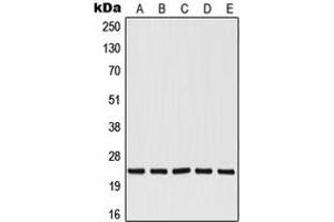 Western Blotting (WB) image for anti-V-Ral Simian Leukemia Viral Oncogene Homolog B (Ras Related, GTP Binding Protein) (Ralb) (Center) antibody (ABIN7296788)