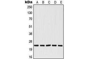 Western blot analysis of RALB expression in HepG2 (A), Jurkat (B), A549 (C), NIH3T3 (D), PC12 (E) whole cell lysates. (RALB 抗体  (Center))