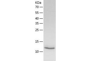 Western Blotting (WB) image for NME/NM23 Nucleoside Diphosphate Kinase 3 (NME3) (AA 22-169) protein (His tag) (ABIN7124185) (NME3 Protein (AA 22-169) (His tag))