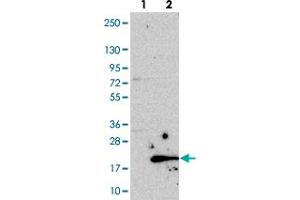 Western blot analysis of Lane 1: Negative control (vector only transfected HEK293T lysate). (C19orf48 抗体)