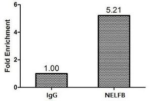 Immunohistochemistry (IHC) image for anti-Cofactor of BRCA1 (COBRA1) (AA 8-199) antibody (ABIN7161139)