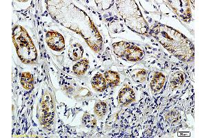 Immunohistochemistry (IHC) image for anti-CD38 (AA 81-180) antibody (ABIN730513)