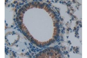 Detection of NPPB in Mouse Lung Tissue using Polyclonal Antibody to Natriuretic Peptide Precursor B (NPPB) (NPPB 抗体  (AA 27-121))