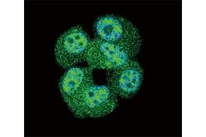 Confocal immunofluorescent analysis of AKT antibody with MCF-7 cells followed by Alexa Fluor 488-conjugated goat anti-rabbit lgG (green). (AKT1 抗体  (AA 428-457))