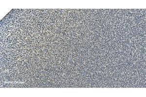 IHC analysis of LSM8 using anti-LSM8 antibody (ABIN7599579). (NAA38 抗体  (AA 1-96))