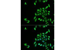 Immunofluorescence analysis of HeLa cells using CSNK1A1L antibody (ABIN5973884). (CSNK1A1L 抗体)