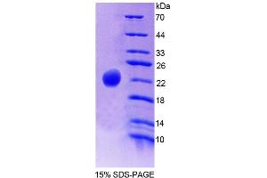 SDS-PAGE (SDS) image for Haptoglobin (HP) (AA 177-342) protein (His tag) (ABIN3209885) (Haptoglobin Protein (HP) (AA 177-342) (His tag))
