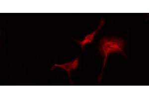 ABIN6274767 staining Hela cells by IF/ICC. (RPL11 抗体  (C-Term))