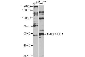 Western blot analysis of extracts of various cell lines, using TMPRSS11A antibody. (TMPRSS11A 抗体)