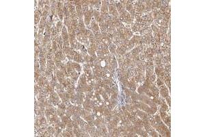 Immunohistochemical staining of human liver with MICAL2 polyclonal antibody  shows moderate cytoplasmic and membranous positivity in hepatocytes.