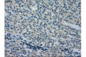 Immunohistochemistry (IHC) image for anti-Dihydrofolate Reductase (DHFR) antibody (ABIN1497822) (Dihydrofolate Reductase 抗体)