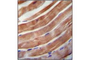 Immunohistochemistry analysis in formalin fixed and paraffin embedded human skeletal muscle reacted with KEAP1 Antibody (C-term) followed which was peroxidase conjugated to the secondary antibody and followed by DAB staining.