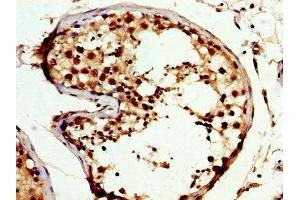 IHC image of ABIN7146628 diluted at 1:300 and staining in paraffin-embedded human testis tissue performed on a Leica BondTM system.