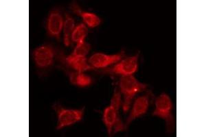 Immunofluorescence (fixed cells) (IF/ICC) image for anti-Thyroid Hormone Receptor, alpha (THRA) (N-Term) antibody (ABIN6265711)