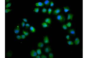 Immunofluorescence staining of Hela cells with ABIN7158363 at 1:66, counter-stained with DAPI. (LMO7 抗体  (AA 1301-1465))