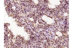 Paraformaldehyde-fixed, paraffin embedded rat lung, Antigen retrieval by boiling in sodium citrate buffer (pH6) for 15min, Block endogenous peroxidase by 3% hydrogen peroxide for 30 minutes, Blocking buffer (normal goat serum) at 37°C for 20min, Antibody incubation with DNA polymerase delta Polyclonal Antibody, Unconjugated  at 1:400 overnight at 4°C, followed by a conjugated secondary and DAB staining.