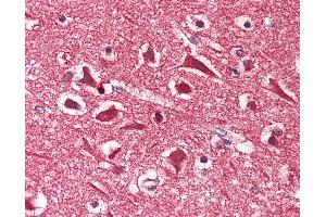 Human Brain, Cortex: Formalin-Fixed, Paraffin-Embedded (FFPE) (MAPRE2 抗体  (AA 300-350))