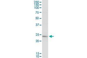 PLA2G16 MaxPab rabbit polyclonal antibody. (PLA2G16 抗体  (AA 1-162))