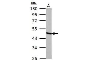 WB Image Fumarate hydratase antibody detects Fumarate hydratase protein by Western blot analysis. (FH 抗体)