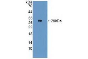 Detection of Recombinant IFNa/bR2, Human using Polyclonal Antibody to Interferon Alpha/Beta Receptor 2 (IFNa/bR2) (IFNAR2 抗体  (AA 27-243))