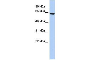 WB Suggested Anti-CCDC96 Antibody Titration: 0. (CCDC96 抗体  (N-Term))
