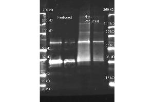 Goat anti Uricase antibody was used to detect purified Uricase under reducing and non-reducing conditions. (Urate Oxidase 抗体)