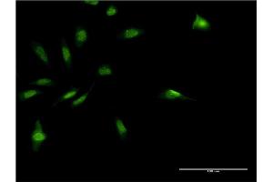 Immunofluorescence of monoclonal antibody to MDFI on HeLa cell. (MDFI 抗体  (AA 33-110))