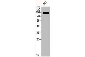 Western Blot analysis of 293 cells using E-cadherin Polyclonal Antibody (CDH1,CDH2,CDH3,CDH4 (C-Term) 抗体)