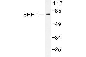 Image no. 1 for anti-Protein-tyrosine Phosphatase 1C (PTPN6) antibody (ABIN271911) (SHP1 抗体)