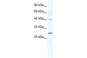 Western Blotting (WB) image for anti-Gap Junction Protein, beta 4, 30.3kDa (GJB4) antibody (ABIN2461387) (GJB4 抗体)
