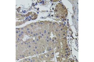 Immunohistochemistry of paraffin-embedded human stomach using UBE2S antibody. (UBE2S 抗体  (AA 122-221))