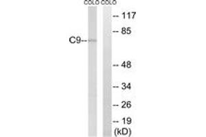 Western blot analysis of extracts from COLO cells, using C9 Antibody. (C9 抗体  (AA 181-230))