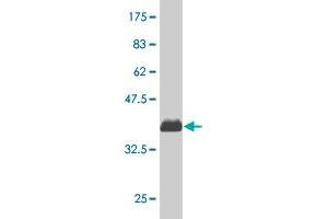 Western Blot detection against Immunogen (35. (CDK4 抗体  (AA 211-303))