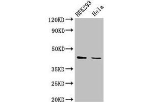 Western Blot Positive WB detected in: HEK293 whole cell lysate, Hela whole cell lysate All lanes: LPGAT1 antibody at 3 μg/mL Secondary Goat polyclonal to rabbit IgG at 1/50000 dilution Predicted band size: 44 kDa Observed band size: 44 kDa (LPGAT1 抗体  (AA 151-341))