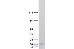 Validation with Western Blot (Gastrin-Releasing Peptide Protein (GRP) (Transcript Variant 3) (Myc-DYKDDDDK Tag))