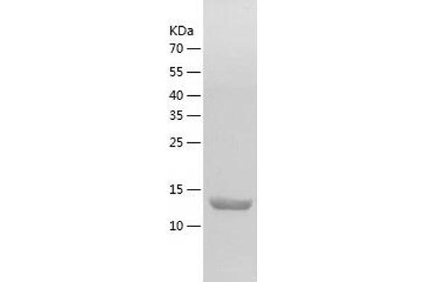 REG1B Protein (AA 24-166) (His tag)