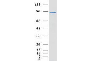 Western Blotting (WB) image for phosphodiesterase 4D, cAMP-Specific (PDE4D) (Transcript Variant 2) protein (Myc-DYKDDDDK Tag) (ABIN2728517)