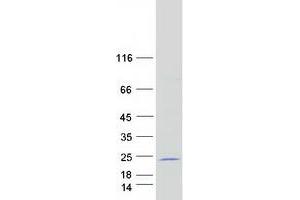 Validation with Western Blot